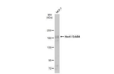 Western Blot: ErbB4/Her4 Antibody [NBP1-33120]