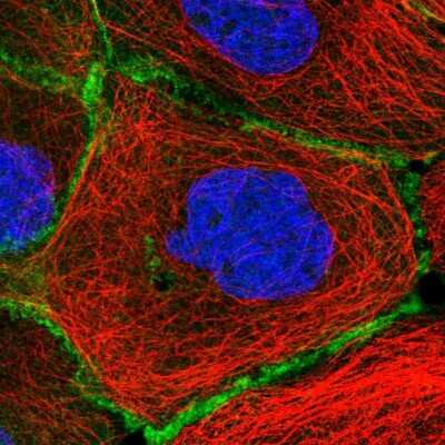 Immunocytochemistry/ Immunofluorescence: Erbin Antibody [NBP2-13968]