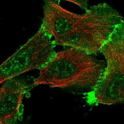 Immunocytochemistry/ Immunofluorescence: Erbin Antibody [NBP2-56104]