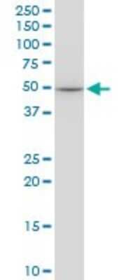 Western Blot: Erythropoietin R Antibody (3D10) [H00002057-M01]