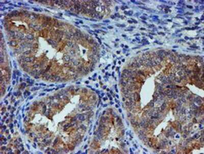 Immunohistochemistry-Paraffin: ER alpha/NR3A1 Antibody (OTI1B1) [NBP2-01371]