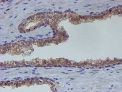 Immunohistochemistry-Paraffin: ER alpha/NR3A1 Antibody (OTI1B1) [NBP2-01371]