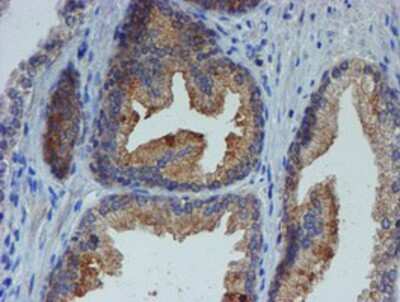 Immunohistochemistry-Paraffin: ER alpha/NR3A1 Antibody (OTI1B1) [NBP2-01371]