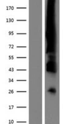 Western Blot: ER alpha/NR3A1 Overexpression Lysate [NBP2-11399]