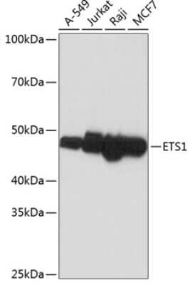 Western Blot: Ets-1 Antibody (5P4K1) [NBP3-15807]