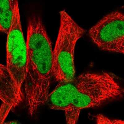 Immunocytochemistry/ Immunofluorescence: Ets-1 Antibody [NBP2-56897]