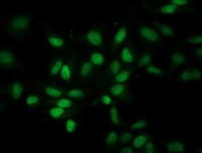Immunocytochemistry/ Immunofluorescence: Eukaryotic translation initiation factor 1 Antibody (OTI2B9) - Azide and BSA Free [NBP2-71554]