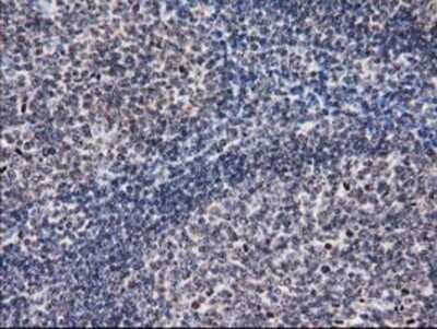 Immunohistochemistry: Eukaryotic translation initiation factor 1 Antibody (OTI2B9) - Azide and BSA Free [NBP2-71554]