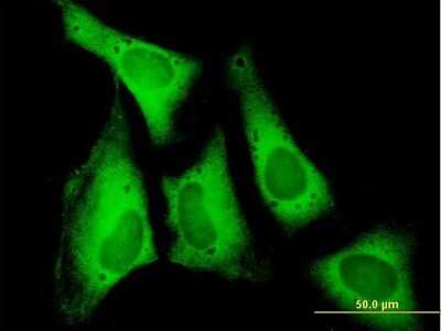 Immunocytochemistry/ Immunofluorescence: Eukaryotic translation initiation factor 5B Antibody [H00009669-B01P]