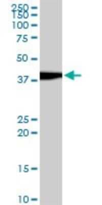 Western Blot: Evx1 Antibody (1B7) [H00002128-M07]