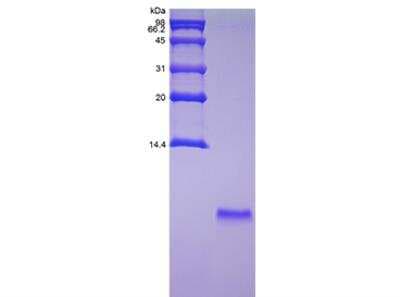SDS-PAGE: Recombinant Exendin-4 Protein [NBP2-34945]