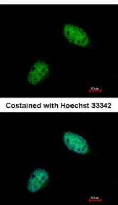 Immunocytochemistry/ Immunofluorescence: Exonuclease 1 Antibody [NBP2-16391]