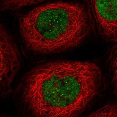 Immunocytochemistry/ Immunofluorescence: Exonuclease 1 Antibody [NBP2-58299]