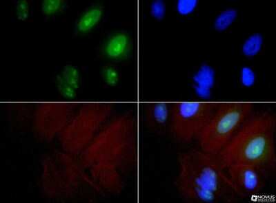 Immunocytochemistry/ Immunofluorescence: Exosome Component 9 Antibody - BSA Free [NBP1-71702]