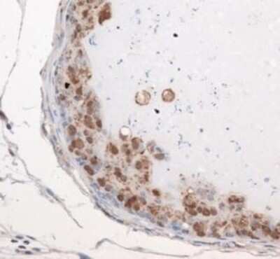 Immunohistochemistry: Exosome Component 9 Antibody - BSA Free [NBP1-71702]