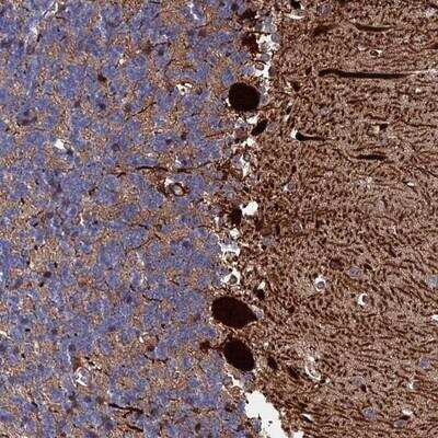 Immunohistochemistry: Exosome Component 9 Antibody [NBP1-87369]