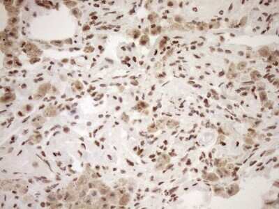 Immunohistochemistry: Exosome component 1 Antibody (OTI1H9) [NBP2-45545]