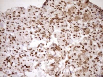 Immunohistochemistry: Exosome component 1 Antibody (OTI1H9) [NBP2-45545]