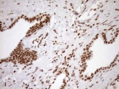 Immunohistochemistry: Exosome component 1 Antibody (OTI1H9) [NBP2-45545]