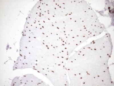Immunohistochemistry: Exosome component 1 Antibody (OTI1H9) [NBP2-45545]