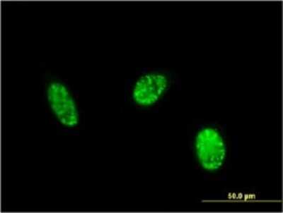 Immunocytochemistry/ Immunofluorescence: Exosome component 1 Antibody (2E9) [H00051013-M01]