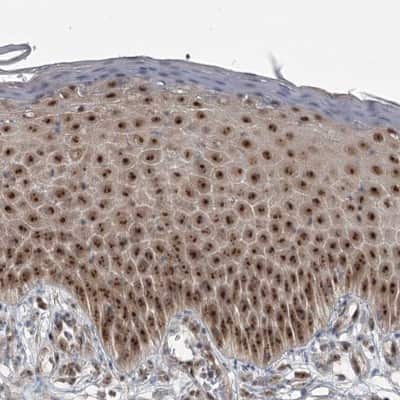 Immunohistochemistry-Paraffin: Exosome component 1 Antibody [NBP1-84523]
