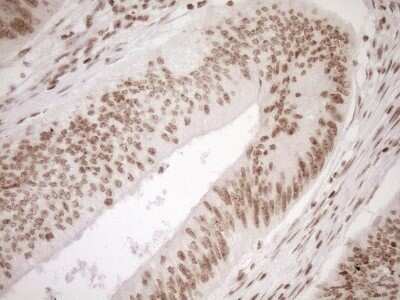 Immunohistochemistry: Exosome component 1 Antibody (OTI1H9) - Azide and BSA Free [NBP2-71895]