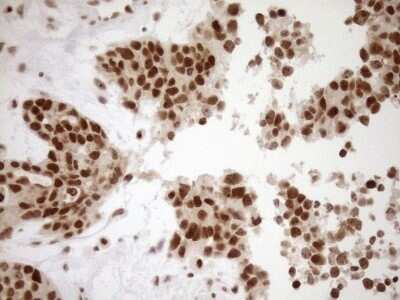 Immunohistochemistry: Exosome component 1 Antibody (OTI1H9) - Azide and BSA Free [NBP2-71895]