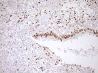 Immunohistochemistry: Exosome component 1 Antibody (OTI1H9) - Azide and BSA Free [NBP2-71895]