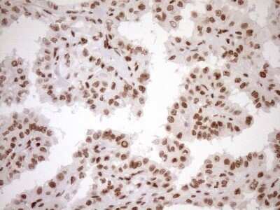 Immunohistochemistry: Exosome component 1 Antibody (OTI1H9) - Azide and BSA Free [NBP2-71895]
