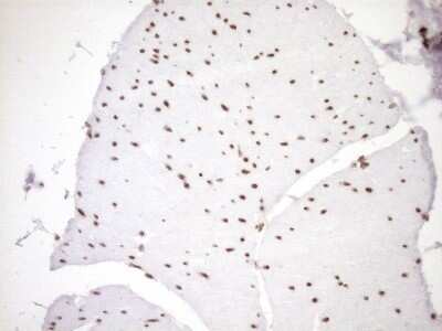 Immunohistochemistry: Exosome component 1 Antibody (OTI1H9) - Azide and BSA Free [NBP2-71895]