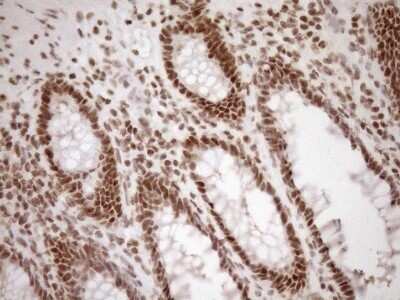 Immunohistochemistry: Exosome component 1 Antibody (OTI1H9) - Azide and BSA Free [NBP2-71895]