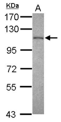 Western Blot: Exosome component 10 Antibody [NBP2-16393]