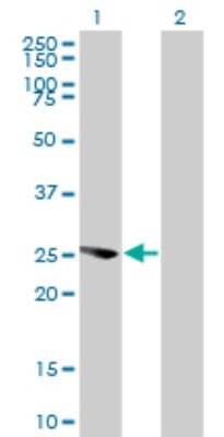 Western Blot: Exosome component 4 Antibody (4F10) [H00054512-M01]