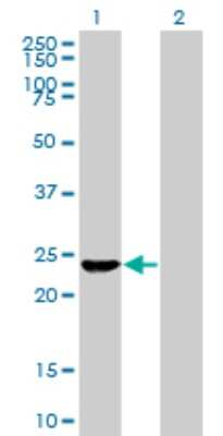 Western Blot: Exosome component 4 Antibody (4F9) [H00054512-M02]