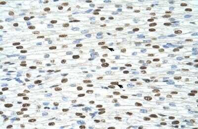 Immunohistochemistry-Paraffin: Exosome component 4 Antibody [NBP1-57180]