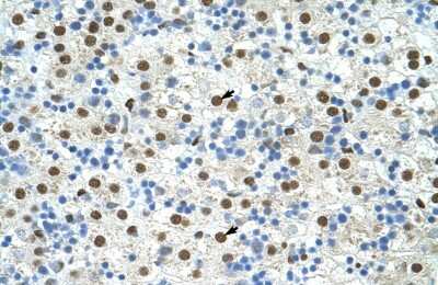 Immunohistochemistry-Paraffin: Exosome component 4 Antibody [NBP1-57180]