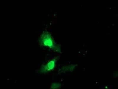 Immunocytochemistry/ Immunofluorescence: Exosome component 7 Antibody (OTI1G8) [NBP2-01732]