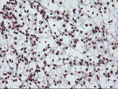 Immunohistochemistry-Paraffin: Exosome component 7 Antibody (OTI1G8) [NBP2-01732]