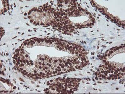 Immunohistochemistry-Paraffin: Exosome component 7 Antibody (OTI1G8) [NBP2-01732]