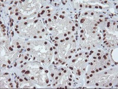Immunohistochemistry-Paraffin: Exosome component 7 Antibody (OTI1G8) [NBP2-01732]