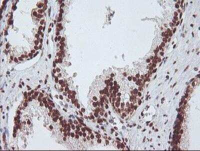 Immunohistochemistry-Paraffin: Exosome component 7 Antibody (OTI1G8) [NBP2-01732]
