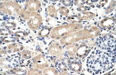 Immunohistochemistry-Paraffin: Exosome component 7 Antibody [NBP1-57199]