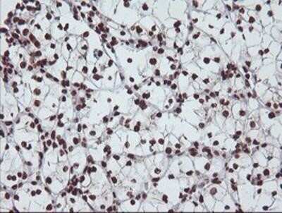 Immunohistochemistry: Exosome component 7 Antibody (OTI1G8) - Azide and BSA Free [NBP2-71722]