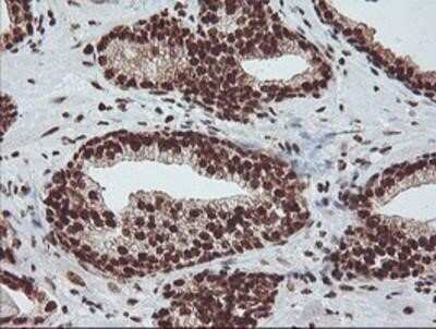 Immunohistochemistry: Exosome component 7 Antibody (OTI1G8) - Azide and BSA Free [NBP2-71722]