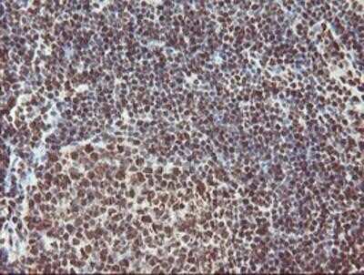 Immunohistochemistry: Exosome component 7 Antibody (OTI1G8) - Azide and BSA Free [NBP2-71722]