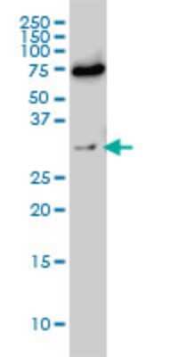 Western Blot: Exosome component 8 Antibody (1G5) [H00011340-M01]