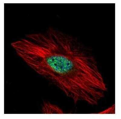 Immunocytochemistry/ Immunofluorescence: Exosome component 8 Antibody [NBP2-14953]