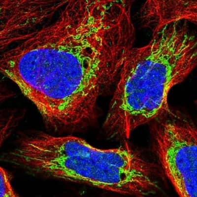 Immunocytochemistry/ Immunofluorescence: Exosome component 8 Antibody [NBP2-47466]