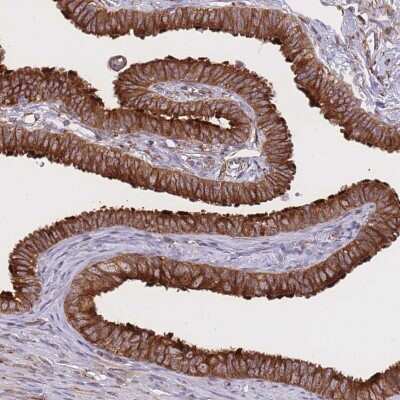 Immunohistochemistry-Paraffin: Exosome component 8 Antibody [NBP2-47465]
